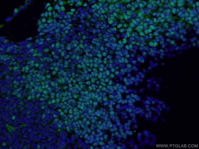 SOX2 Antibody in Immunohistochemistry (PFA fixed) (IHC (PFA))