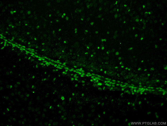 SOX2 Antibody in Immunohistochemistry (PFA fixed) (IHC (PFA))