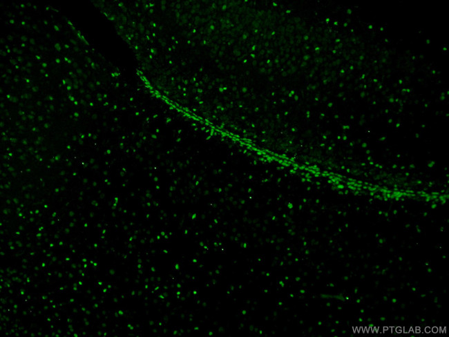 SOX2 Antibody in Immunohistochemistry (PFA fixed) (IHC (PFA))