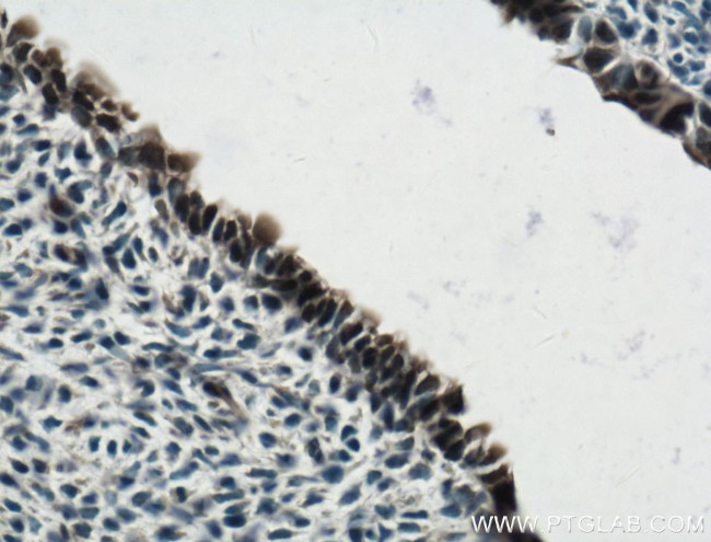 SOX2 Antibody in Immunohistochemistry (Paraffin) (IHC (P))