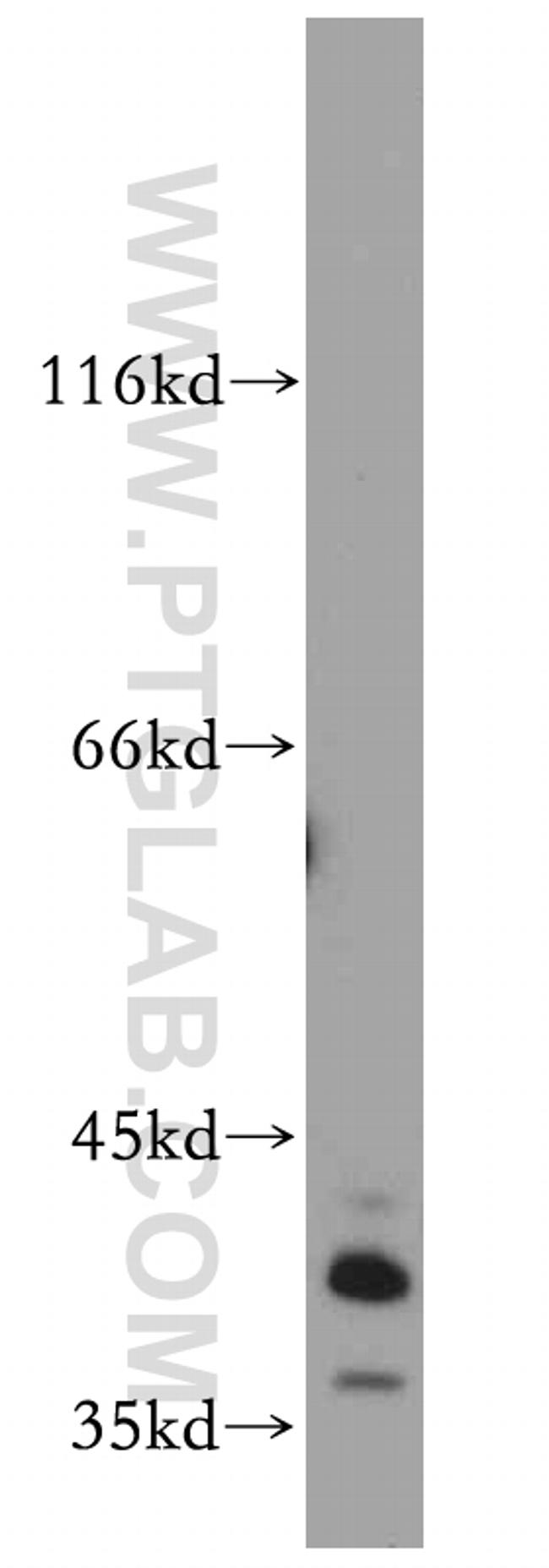 SOX2 Antibody in Western Blot (WB)