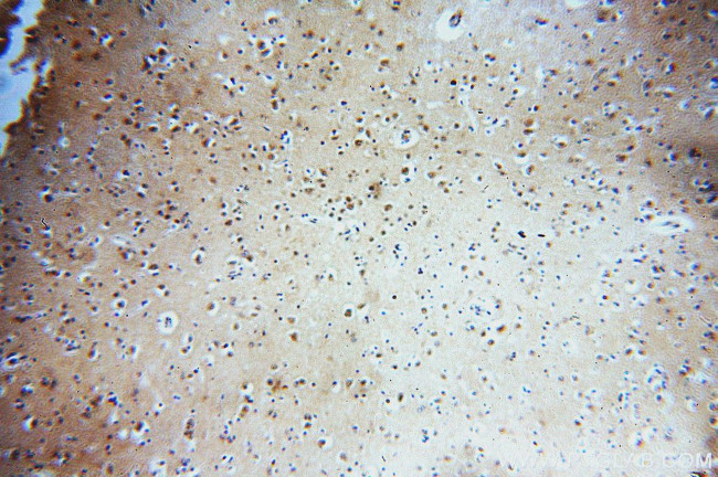 ZCCHC11 Antibody in Immunohistochemistry (Paraffin) (IHC (P))