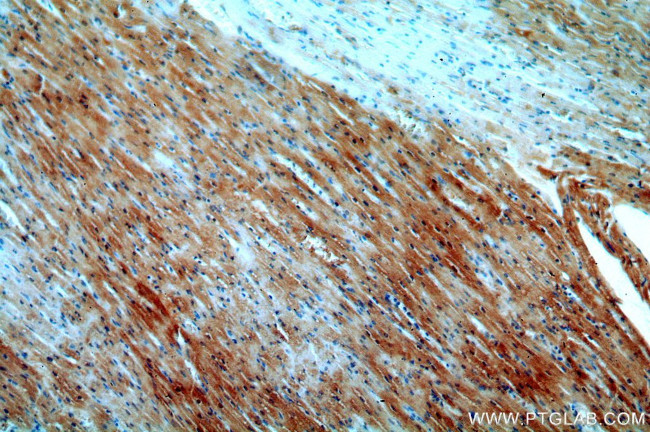 APOBEC2 Antibody in Immunohistochemistry (Paraffin) (IHC (P))