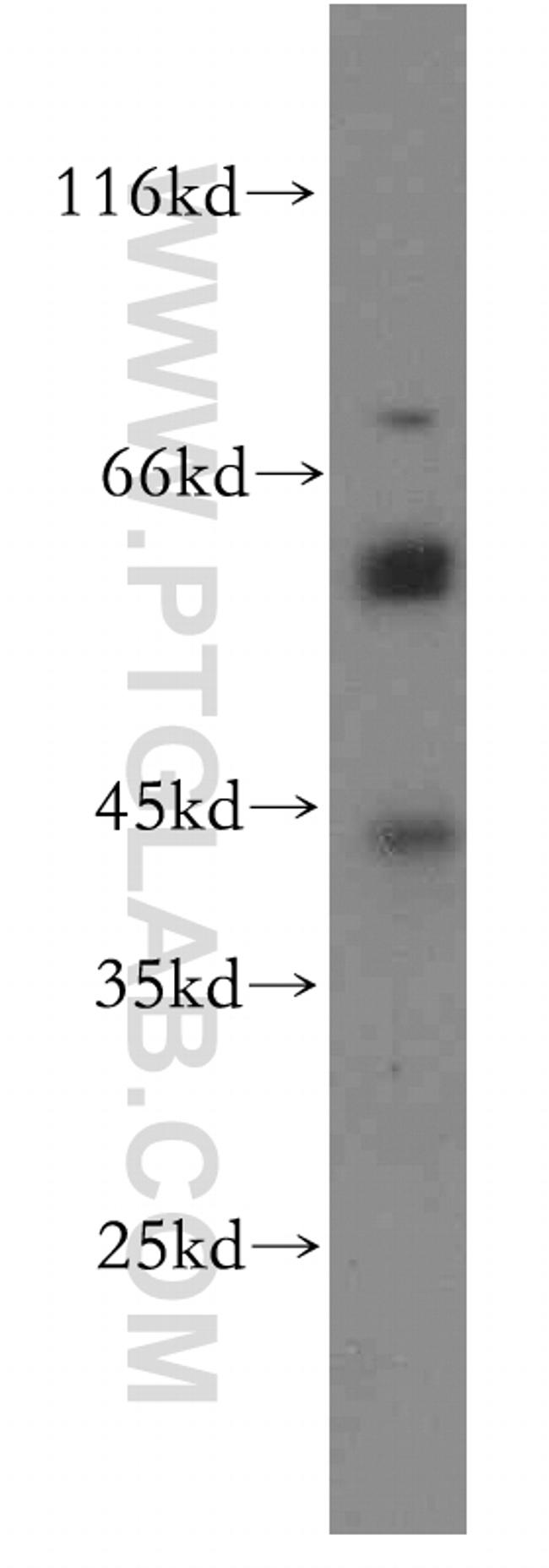 WDR13 Antibody in Western Blot (WB)