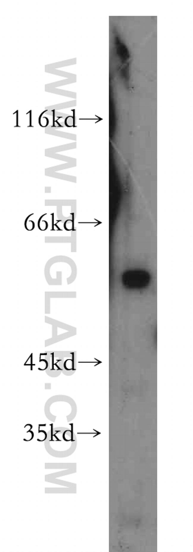 WDR13 Antibody in Western Blot (WB)