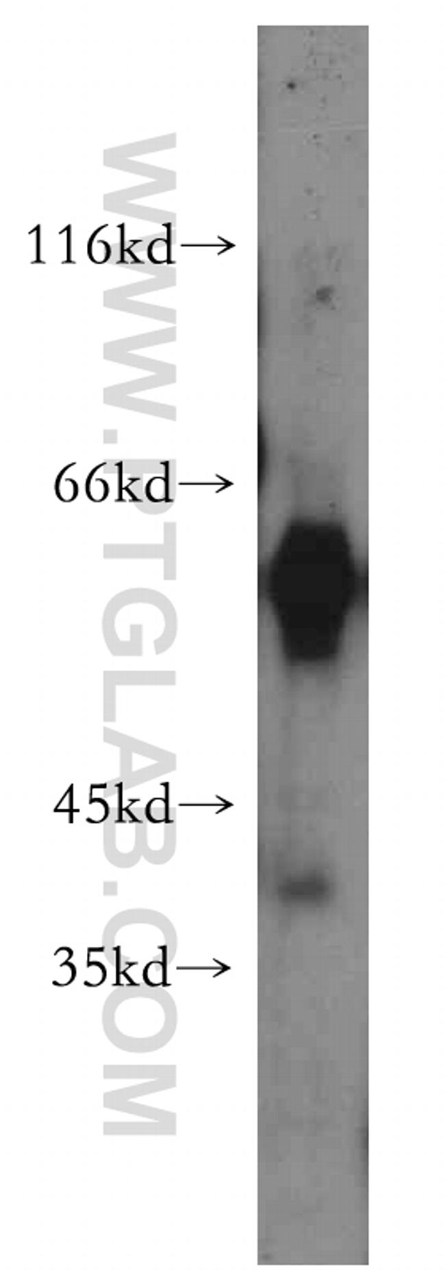 WDR13 Antibody in Western Blot (WB)