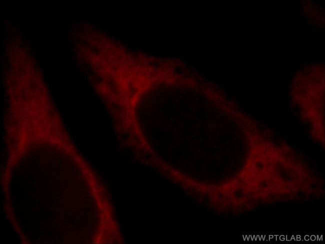 CUEDC2 Antibody in Immunocytochemistry (ICC/IF)