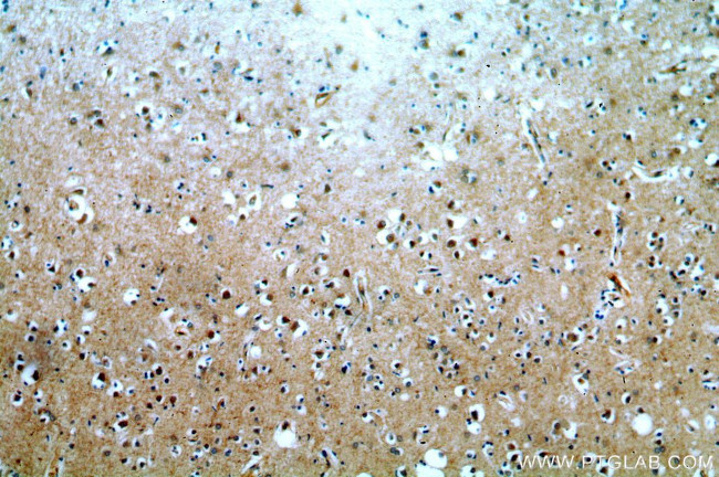 CUEDC2 Antibody in Immunohistochemistry (Paraffin) (IHC (P))