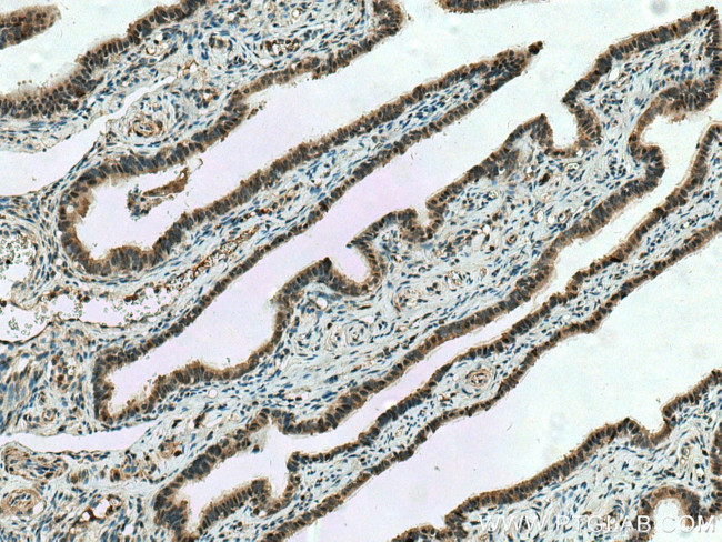 CUEDC2 Antibody in Immunohistochemistry (Paraffin) (IHC (P))