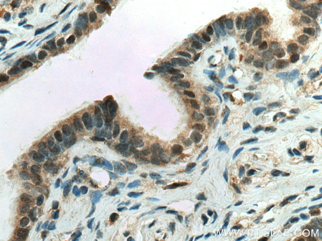 CUEDC2 Antibody in Immunohistochemistry (Paraffin) (IHC (P))