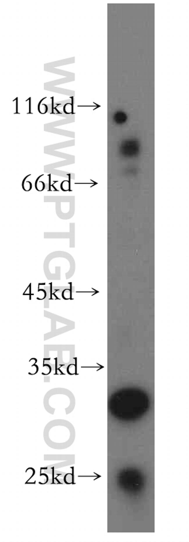 CUEDC2 Antibody in Western Blot (WB)