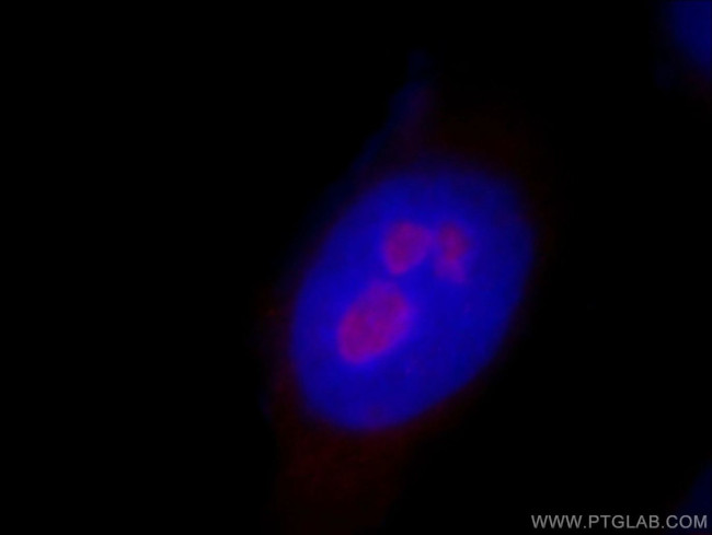 RRP8 Antibody in Immunocytochemistry (ICC/IF)