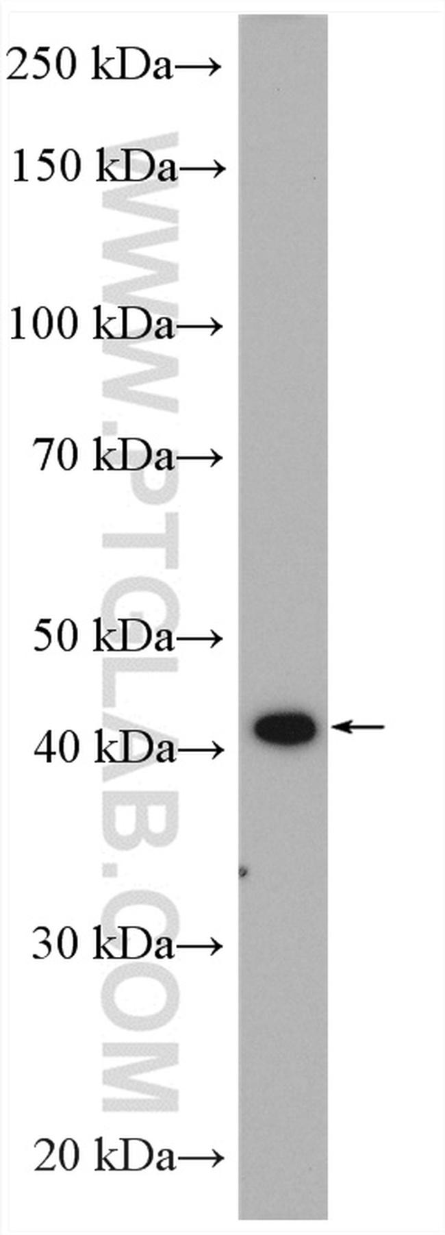 GTPBP5 Antibody in Western Blot (WB)