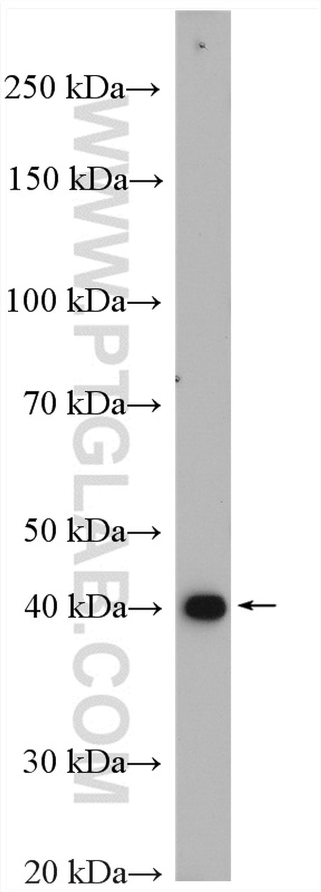 GTPBP5 Antibody in Western Blot (WB)