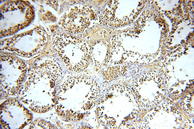 GTPBP5 Antibody in Immunohistochemistry (Paraffin) (IHC (P))