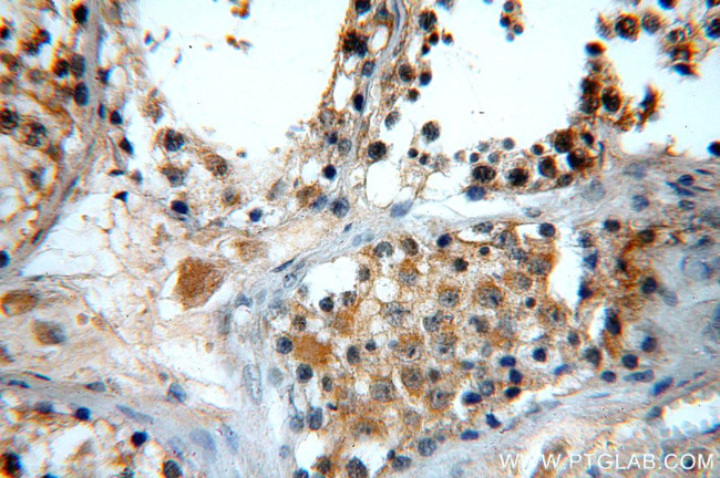 GTPBP5 Antibody in Immunohistochemistry (Paraffin) (IHC (P))