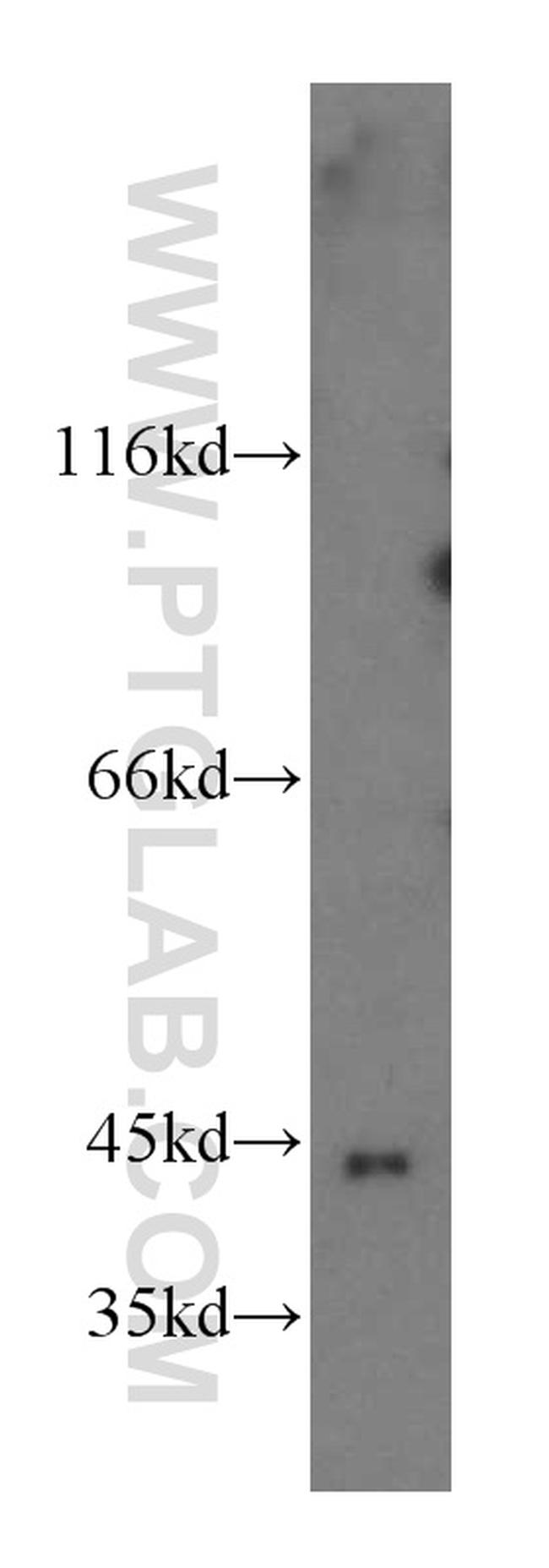 GTPBP5 Antibody in Western Blot (WB)