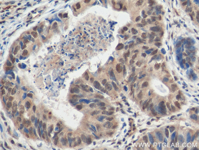 ZHX2 Antibody in Immunohistochemistry (Paraffin) (IHC (P))