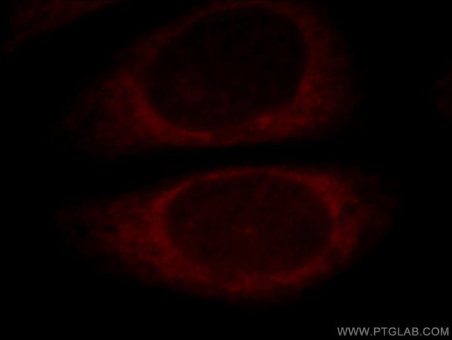 EXD2 Antibody in Immunocytochemistry (ICC/IF)