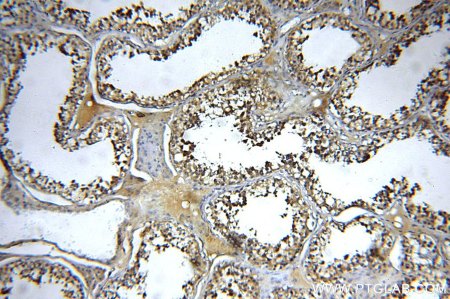 EXD2 Antibody in Immunohistochemistry (Paraffin) (IHC (P))