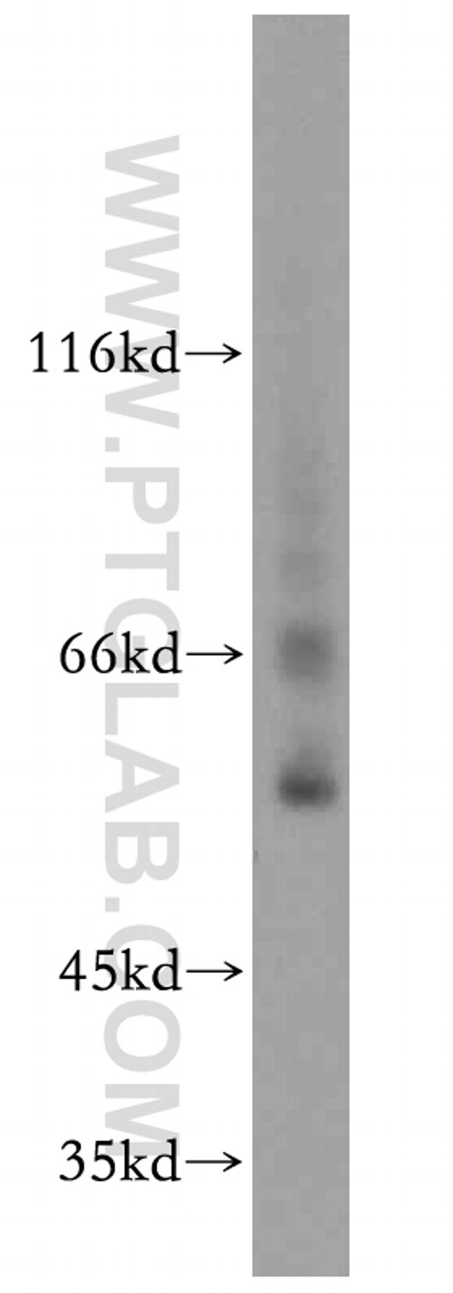 EXD2 Antibody in Western Blot (WB)