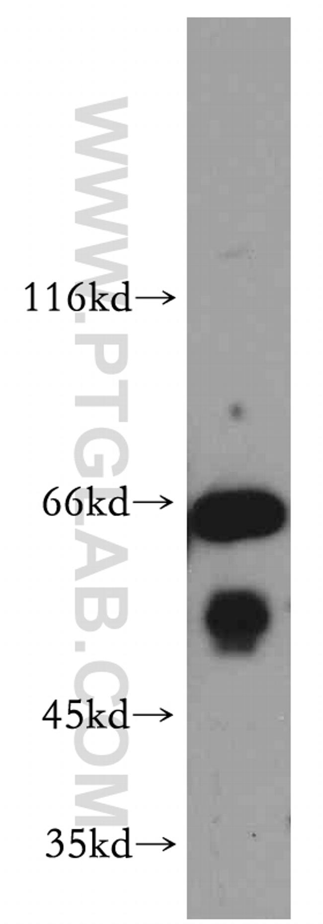 EXD2 Antibody in Western Blot (WB)