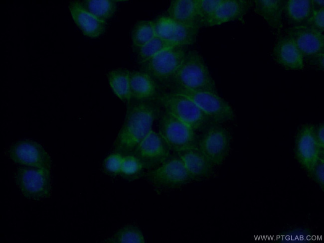 MCT1 Antibody in Immunocytochemistry (ICC/IF)