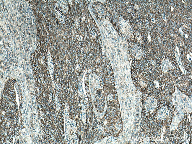 MCT1 Antibody in Immunohistochemistry (Paraffin) (IHC (P))