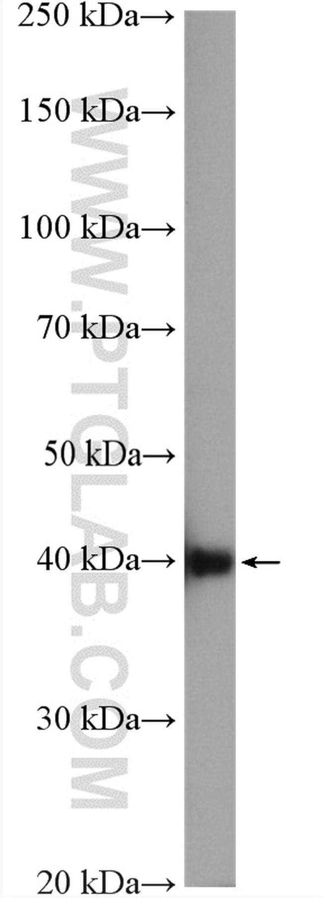 MCT1 Antibody in Western Blot (WB)