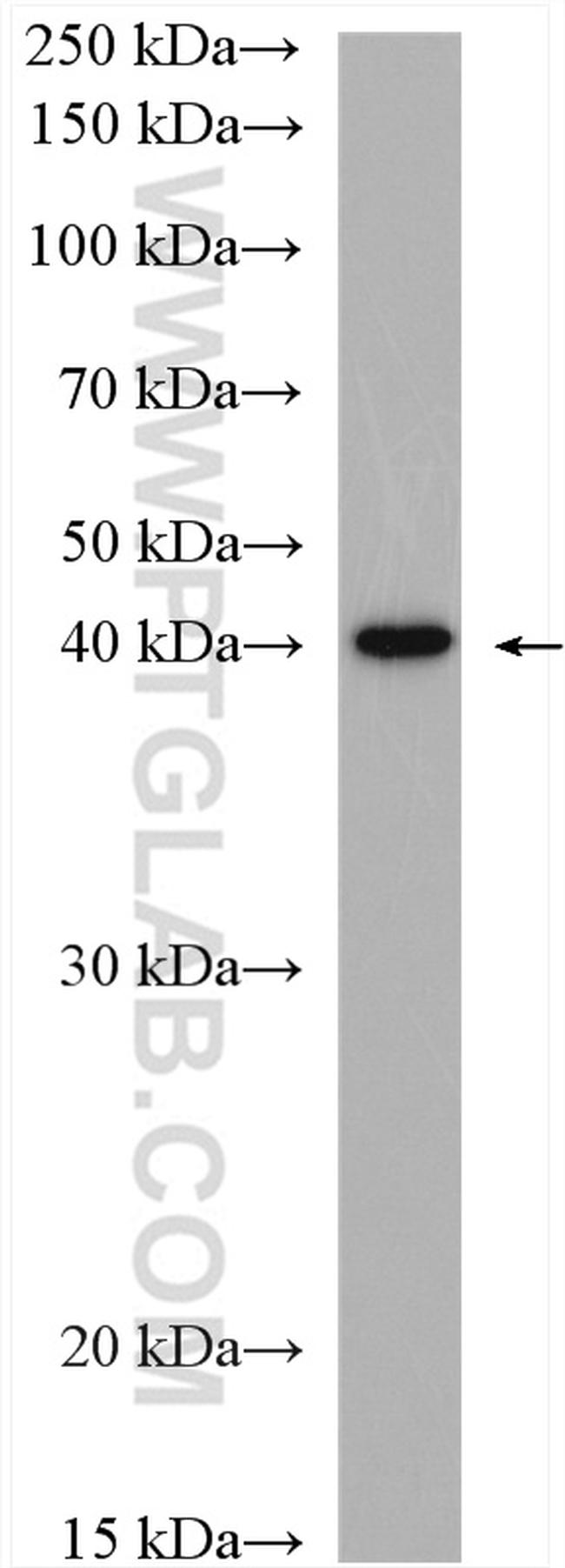 MCT1 Antibody in Western Blot (WB)