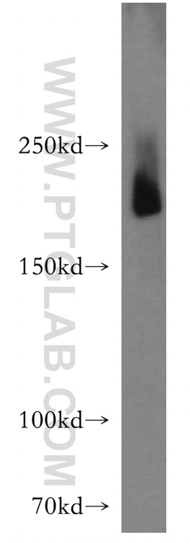 MYH4 Antibody in Western Blot (WB)