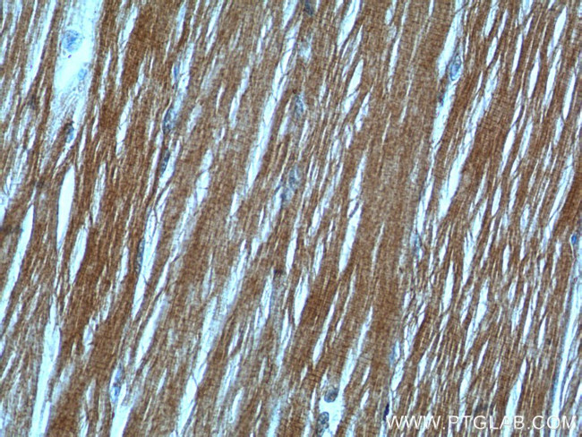 MYH4 Antibody in Immunohistochemistry (Paraffin) (IHC (P))