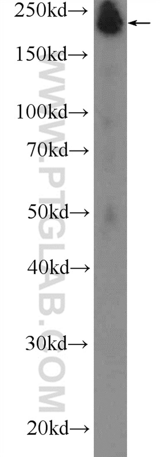 MYH4 Antibody in Western Blot (WB)