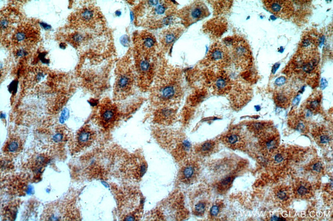 CHST13 Antibody in Immunohistochemistry (Paraffin) (IHC (P))