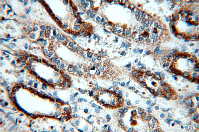 CHST13 Antibody in Immunohistochemistry (Paraffin) (IHC (P))