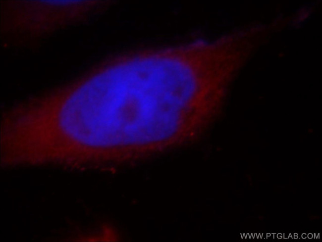 SHP2 Antibody in Immunocytochemistry (ICC/IF)