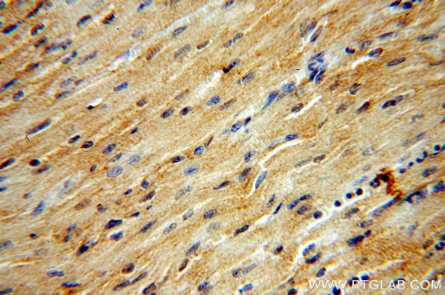 SHP2 Antibody in Immunohistochemistry (Paraffin) (IHC (P))