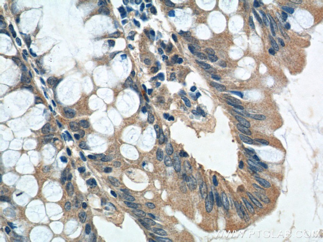 GPR81 Antibody in Immunohistochemistry (Paraffin) (IHC (P))