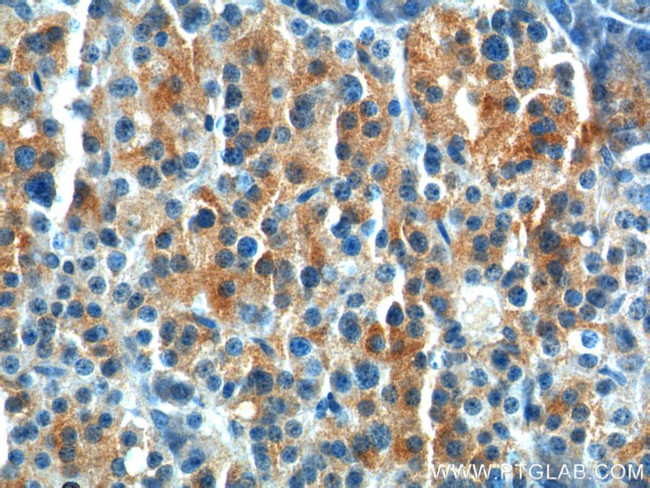 GPR81 Antibody in Immunohistochemistry (Paraffin) (IHC (P))