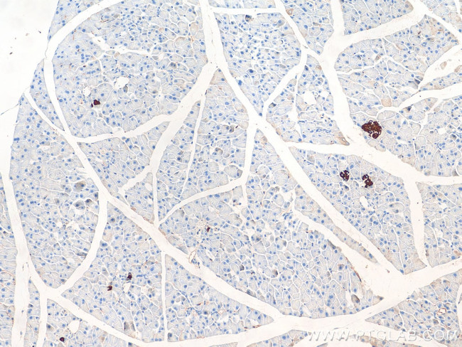 GPR81 Antibody in Immunohistochemistry (Paraffin) (IHC (P))