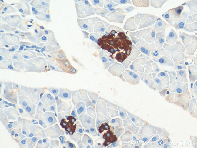 GPR81 Antibody in Immunohistochemistry (Paraffin) (IHC (P))