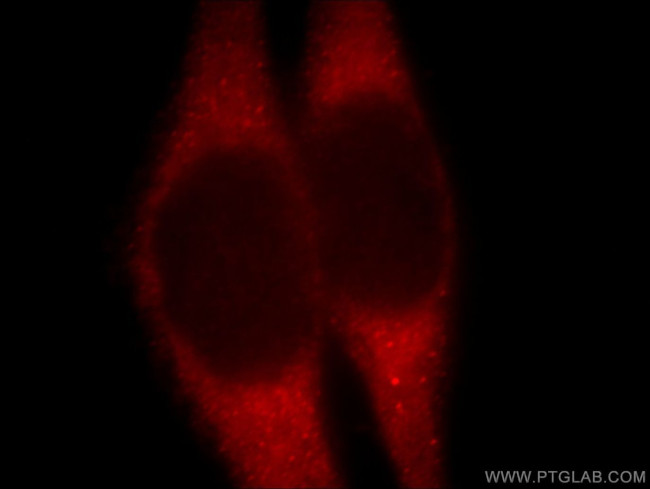 B4GALT6 Antibody in Immunocytochemistry (ICC/IF)