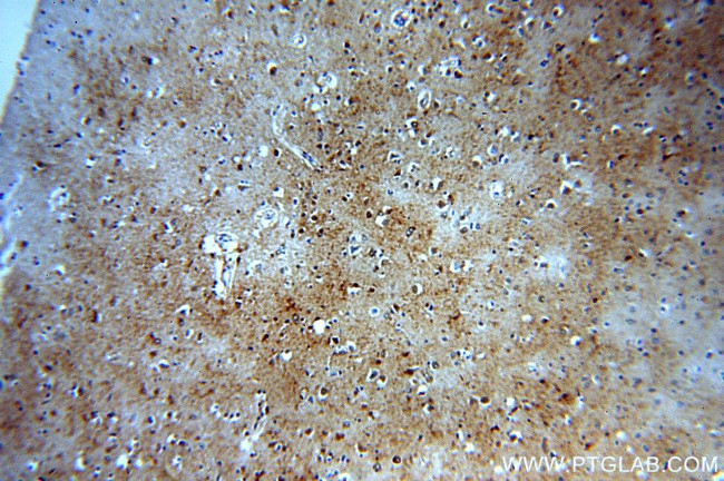 B4GALT6 Antibody in Immunohistochemistry (Paraffin) (IHC (P))