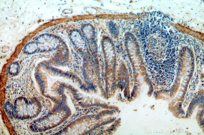 B4GALT6 Antibody in Immunohistochemistry (Paraffin) (IHC (P))