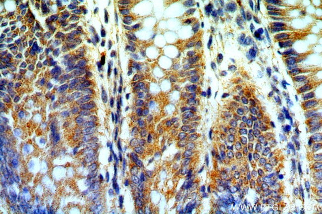 B4GALT6 Antibody in Immunohistochemistry (Paraffin) (IHC (P))