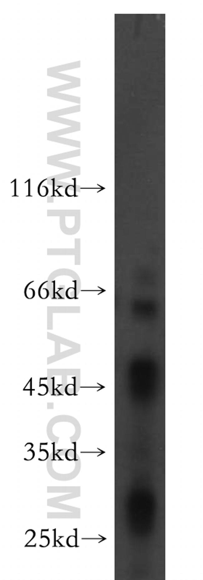 B4GALT6 Antibody in Western Blot (WB)