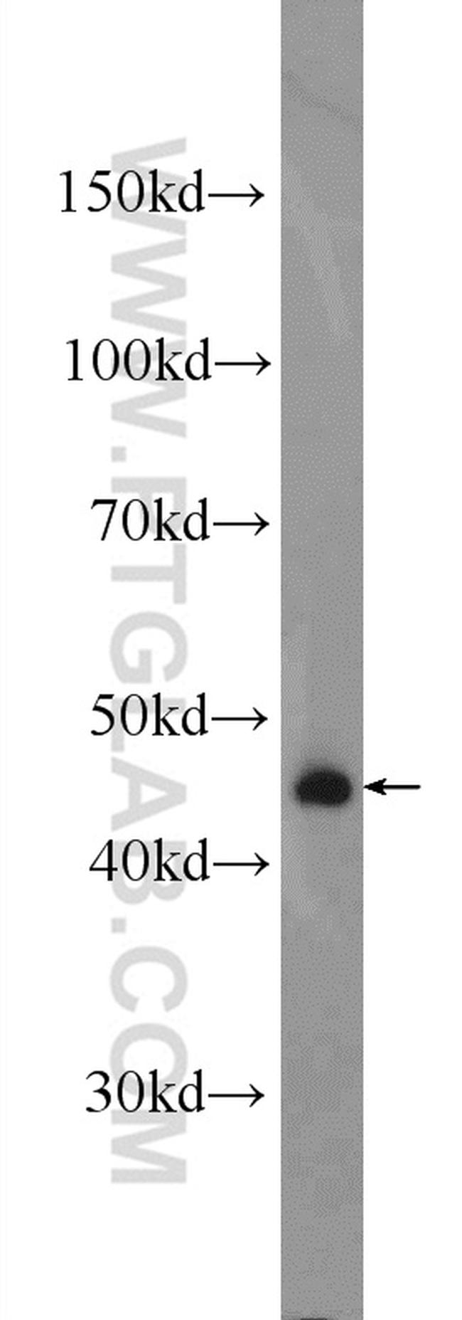 B4GALT6 Antibody in Western Blot (WB)