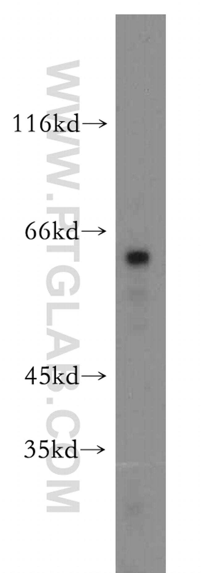 B4GALT6 Antibody in Western Blot (WB)