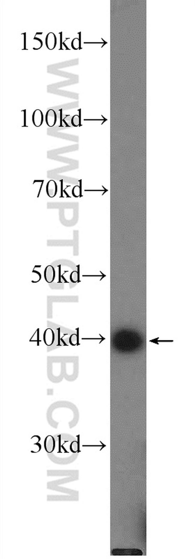 B4GALT6 Antibody in Western Blot (WB)