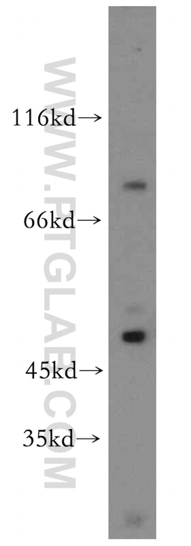 DDX51 Antibody in Western Blot (WB)